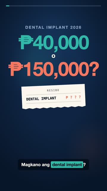 Magkano ang Dental Implant? ₱40,000 – ₱150,000 kada Ngipin (2026)