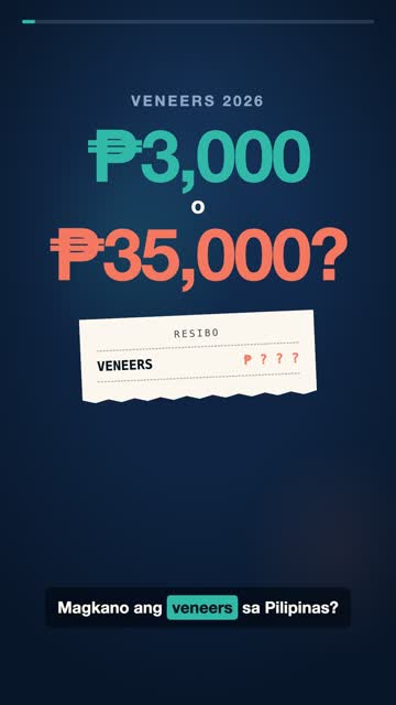 Magkano ang Veneers? ₱3,000 – ₱35,000 Bawat Ngipin sa Pilipinas (2026)